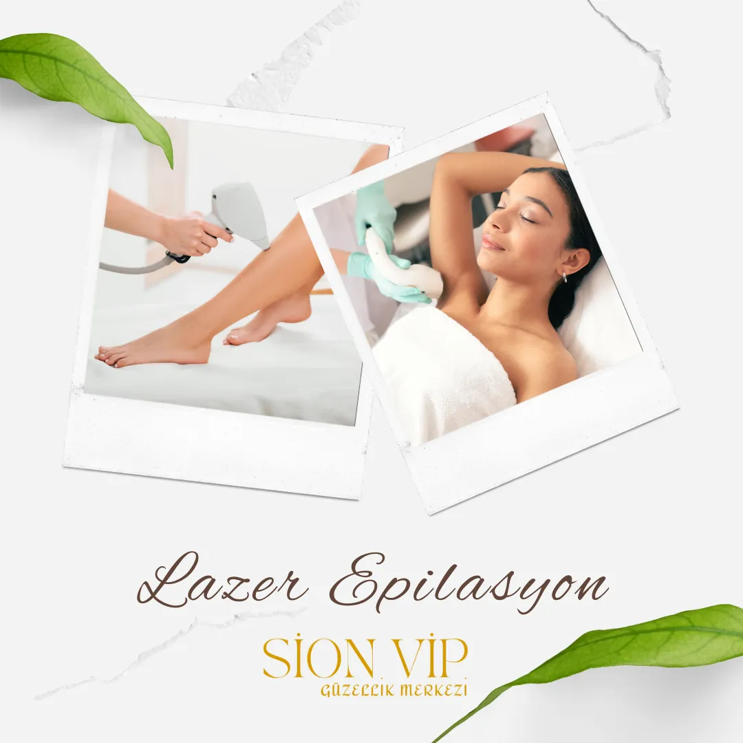 Lazer Epilasyon